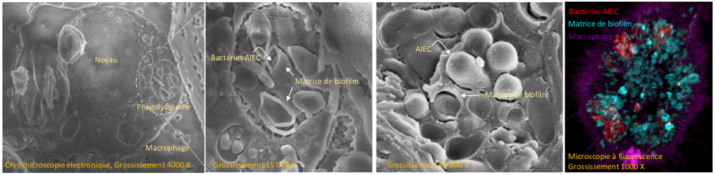 Observation-macrophages-infectés